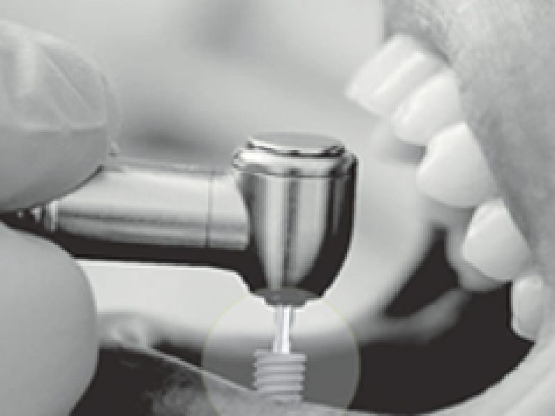 main-drilling-sequence